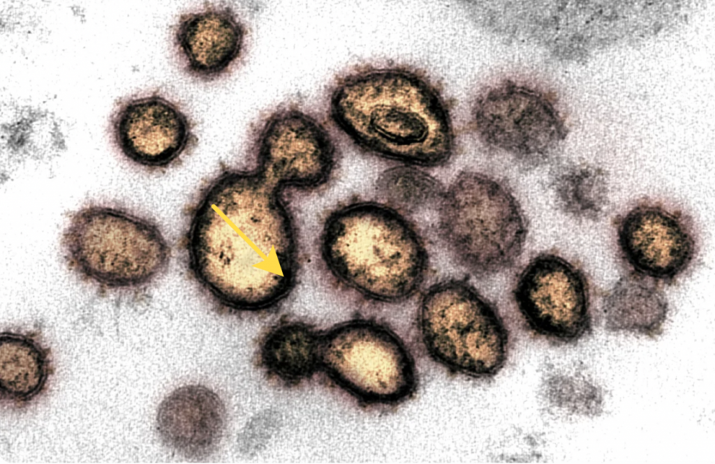Шипы на вирусе напоминают корону, отсюда и название. Фото NIAID’s Rocky Mountain Laboratories (RML)