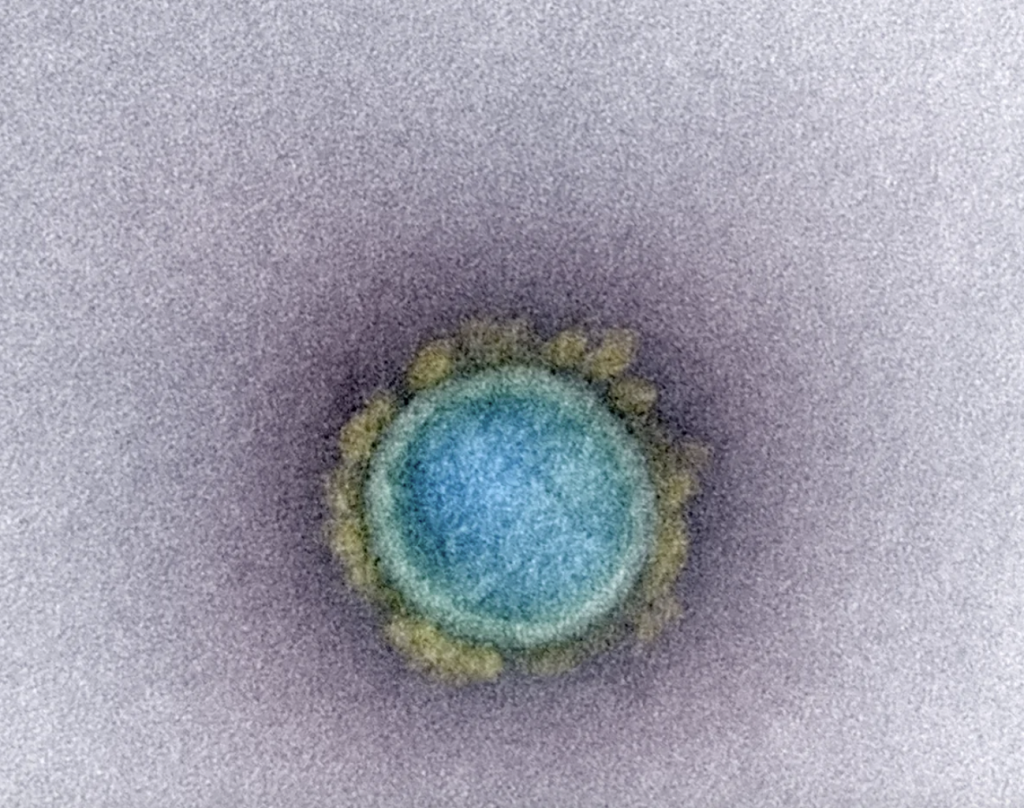«Селфи» коронавируса COVID-19 под электронным сканирующим микроскопом. Фото NIAID’s Rocky Mountain Laboratories (RML)